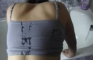 కొవ్వు తొలగింపు