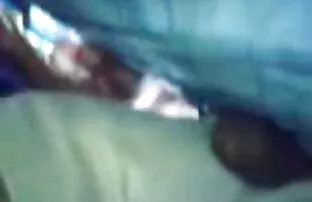 కుష్ఠురోగి 72